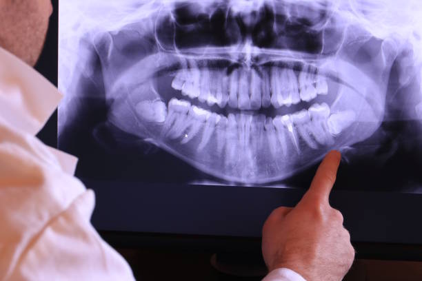 Best Emergency Root Canal Treatment in Hokendauqua, PA