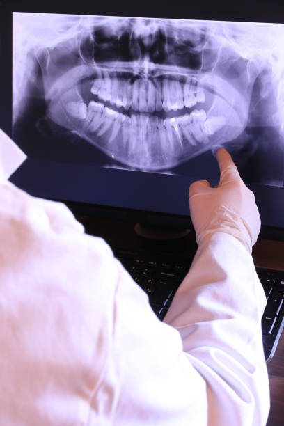Best Emergency Wisdom Teeth Removal in Hokendauqua, PA